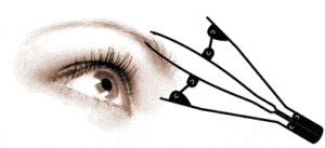 Epilmatic 1